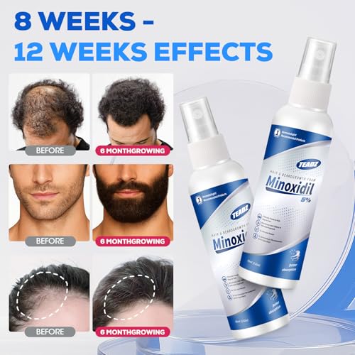 5% Minoxidil Hair Growth Serum for Men & Women