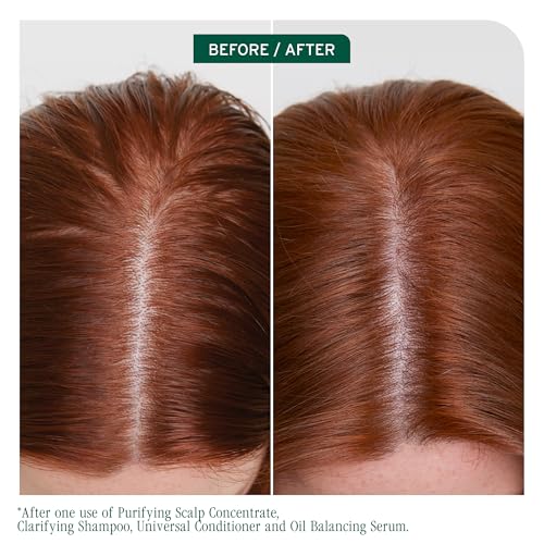 Biolage Scalp Sync Clarifying Shampoo - Residue & Buildup Remover, For Oily Scalp