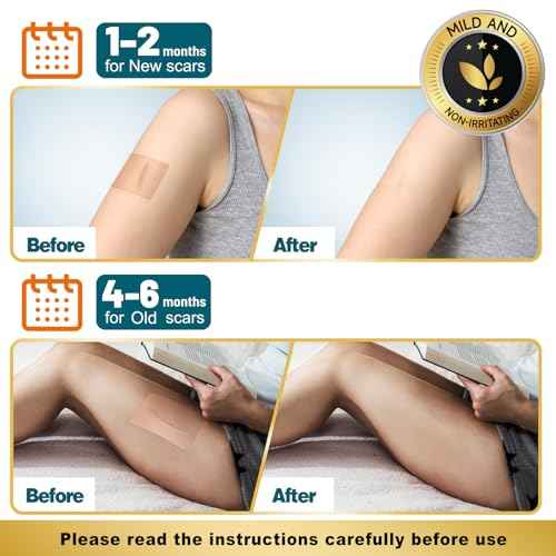 Arme Silicone Scar Tape, 1.6" x 240" Silicone Scar Sheets(2 Rolls-6M), Medical Grade Scar Tape Removal Sheets for Surgical Scars, Reusable Scar Removal Strips for Tummy Tuck C-Section Keloid