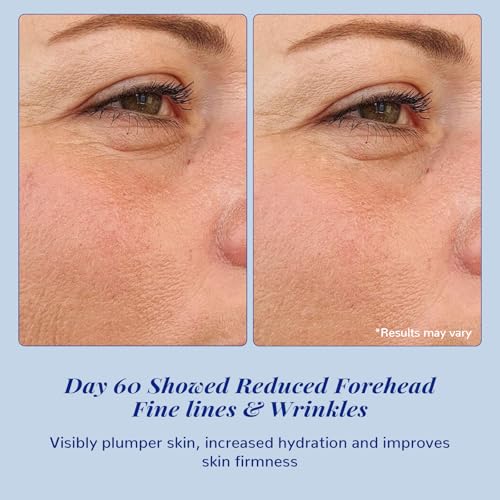 ANAI RUI 10% Argireline Serum+ Matrixyl 3000 Pure Hyaluronic Acid For Face Deep Wrinkle Reducer,Anti-Aging, Collagen Boosting, Peptides Serum for Face1.05 Fl.oz