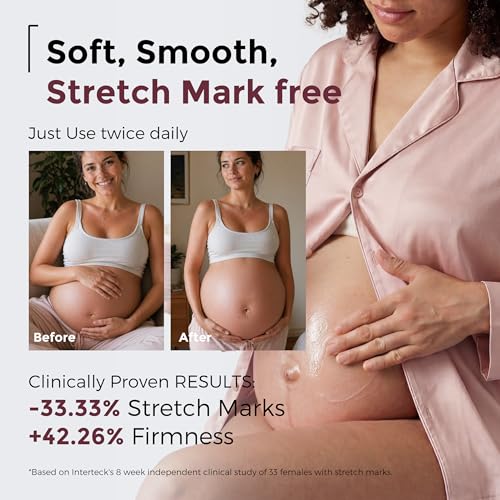 Momcozy Stretch Mark Cream for Pregnancy - 5.29oz