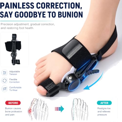 White Bunion Corrector for Women & Men - Adjustable Gel Toe Splint for Day & Night Relief