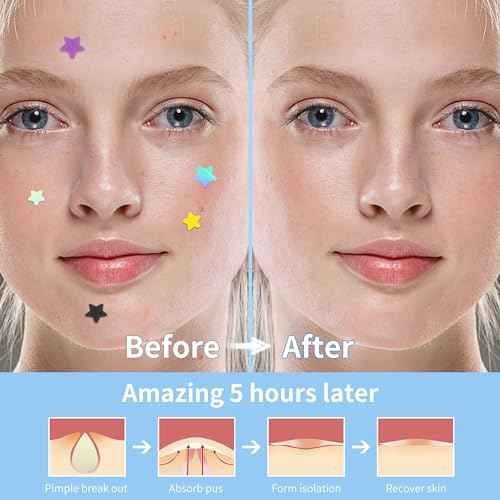 Pimple Patches for Face, 3 Size 280 Counts Hydrocolloid Acne Patches, Cute Star Pimple Stickers with Salicylic Acid, Tea Tree Oil & Calendula Oil, for Covering Zits and Blemishes