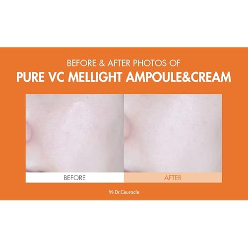 Dr.Ceuracle by leegeehaam Pure VC Mellight Ampoule - Vitamin C Serum for Face, One Week Program for Anti-oxidant, Firm, Clarify, Fade Pigmentation, Skin Radiance (1 Count (Pack of 1))