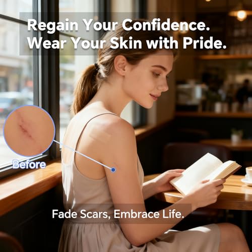 Professional Silicone Scar Sheets, Silicone Scar Tape, Silicone Scar Patch, Reusable Scar Silicone Strips (1.5M)