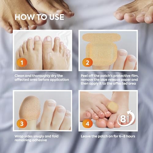Natural Vine Toenail Fungus Treatment Patches - Extra Strength 1% Tolnaftate, 32 Patches for Overnight Renewal