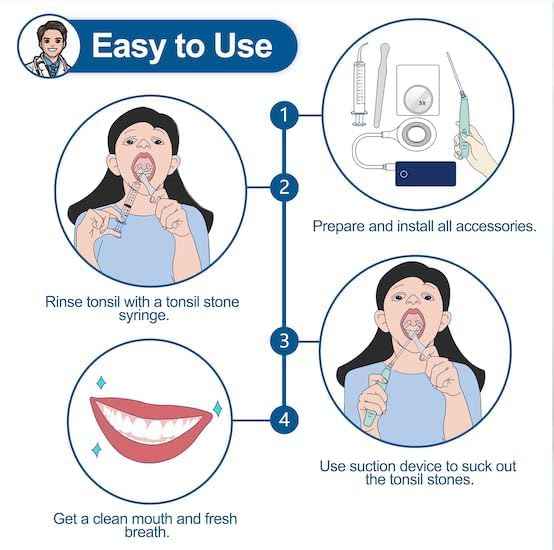 Tonsil Stone Remover, High-Precision & Painless Comfortable Cleaning, 12 in 1 Tonsil Stone Removal Kit, 150 Degree Rotate Electronic Tonsil Stone Vacuum, Best Tonsil Stone Removal Tool (Green)