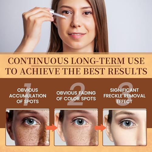 Vitamin C Face Serum, Vitamin C Serum For Face, 100% Pure Vitamin C Serum For Facial Moisturizing, Firming Skin, And Even Skin Tone - 30 ml