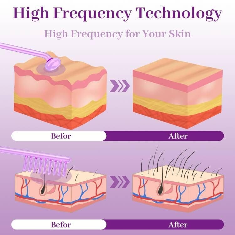 TUMAKOU High Frequency Facial Wand with 4 Tubes