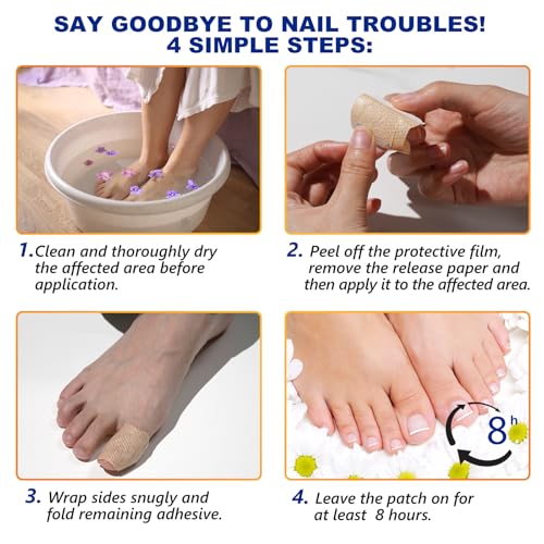 Overnight Toenail Care Patches for Dry & Damaged Nails - 2 Pack