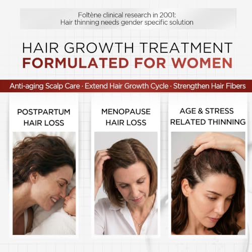 Foltene Hair Growth Serum for Women 35+ – Clinically Proven, 12 Vials