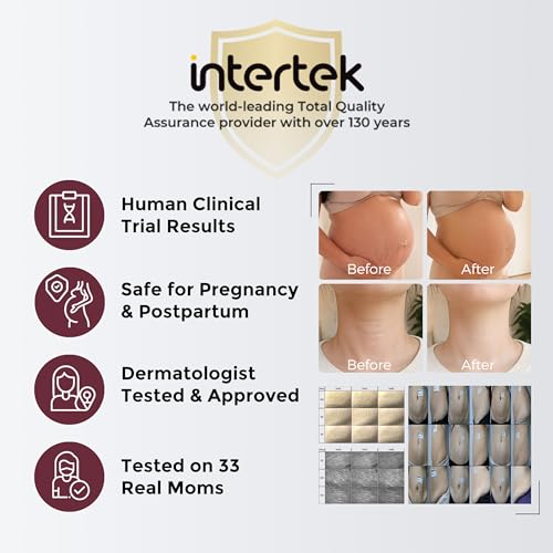 Momcozy Stretch Mark Cream for Pregnancy - 5.29oz