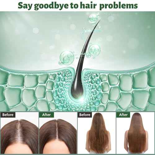 Biotin & Rosemary Hair Growth Shampoo?Natural Formula for Thinning Hair & Hair Loss, Promotes Thicker, Fuller Hair,Hair Growth Shampoo for Men and Women - 10.15 fl OZ