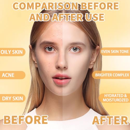 Jelly Mask Set, Hyalorunic Acid Jelly Masks For Facials Professional,Vitamins C Jelly Face Mask, Facial Mask Mixing Bowl Set, Headband, Birthday Gifts Set for Women,Christmas Thanksgiving Gift Set.