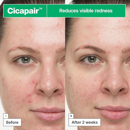Dr.Jart+ Cicapair So Soothing Face Treatment Korean Gel Cream for Visibly Irritated Skin with Centella Asiatica | Korean Skin Care, 1.01 Fl Oz