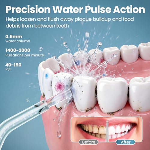 Onlyone Rechargeable Water Flosser with Adjustable Pressure
