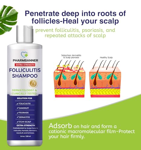 Anti-Fungal Medicated Shampoo for Seborrheic Dermatitis & Folliculitis