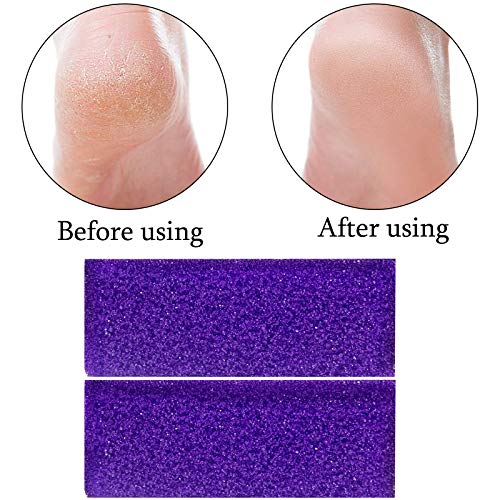 40 Pcs Pumice Stones for Feet - Callus Remover and Foot Scrubber