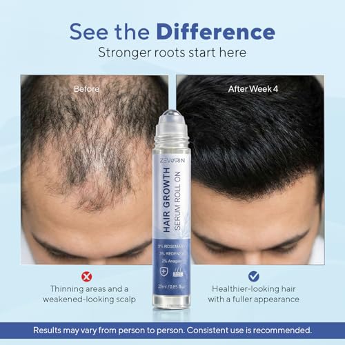 Hair Growth Serum Roll-On with Rosemary & Redensyl - Thicker Fuller Hair Support
