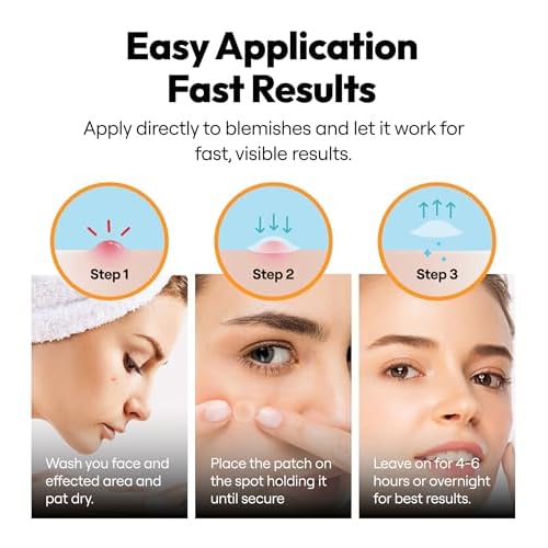 300 Pimple Patches ? Hydrocolloid Zit Stickers with Salicylic Acid, Tea Tree & Calendula | Helps Reduce Visible Blemishes ? Gentle, Overnight Skin Care
