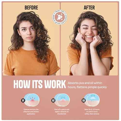 Pimple Patches for Face ? Day & Night Acne Patches for Fast Healing, Skin Clarity ? Invisible Hydrocolloid Patches, Waterproof Spot Treatment ? All Skin Types Zit Patches of 60/120/180