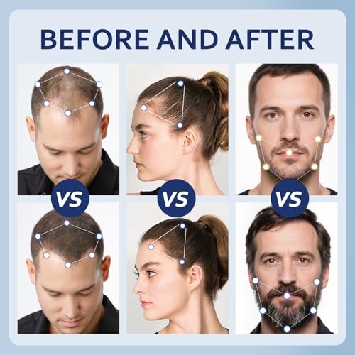 5% Minoxidil Hair Growth Serum for Men & Women - 6 FL OZ