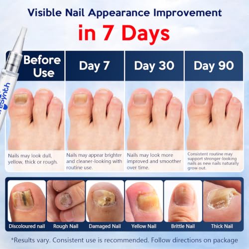 PureSynth Extra Strength Nail Repair Pen - 25% Undecylenic Acid, Aloe & Vitamin E, 4 Pack