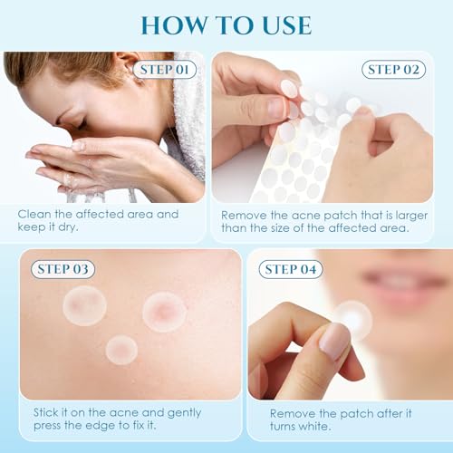 Pimple Patches Acne Patches, PITHER Day and Night Hydrocolloid Patch for Covering Zits and Blemishes Invisible Zit Patches with Tea Tree Oil, Salicylic Acid, Centella Asiatica (288 Count, 2 Size)