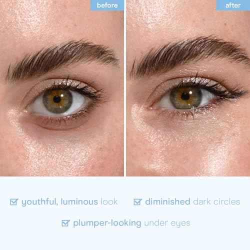 Baebody Advanced Snail Mucin Under Eye Patches for Women & Men (6 Pairs) - Under Eye Masks for Dark Circles and Puffiness - With Niacinamide - Reduce Fine Lines and Wrinkles