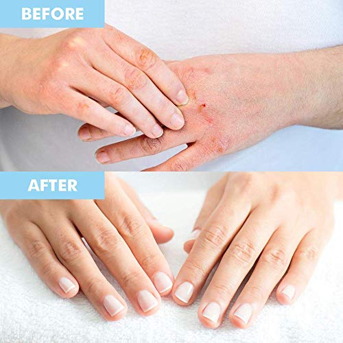 Bodipure Keratin Hand and Foot Mask Combo Set for Dry, Calloused Skin