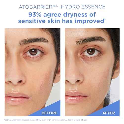 AESTURA ATOBARRIER365 Hydro Essence with Hydrating Amino Acids for Face | Lightweight Formula, Deep Hydration, Suitable for Dry & Sensitive Skin, Non-Comedogenic, 100ML / 3.38 fl. oz.