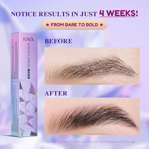 Lash & Brow Growth Serum Set - Eyelash & Eyebrow Serum with Biotin, Peptides & Plant Extracts - Fuller, Longer-Looking Lashes & Thicker Brows - Vegan, Prostaglandin-Free, 2¡¿ 8ml Value Duo
