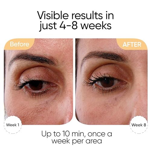 Sensica Sensilift Anti-Aging RF Skin Tightening Device for Face & Neck