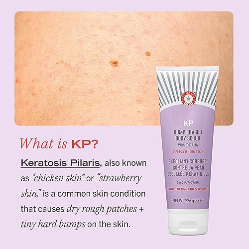 First Aid Beauty KP Bump Eraser Body Scrub Exfoliant for Keratosis Pilaris with 10% AHA 2 oz.