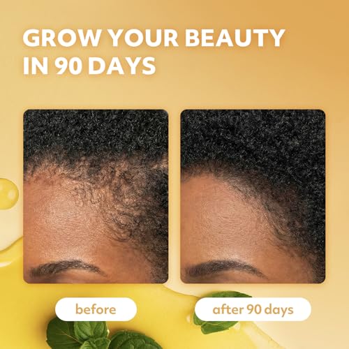 Batana & Natural Oils Hair Growth Formula - 12-in-1 Scalp Oil for Thicker, Healthier Hair