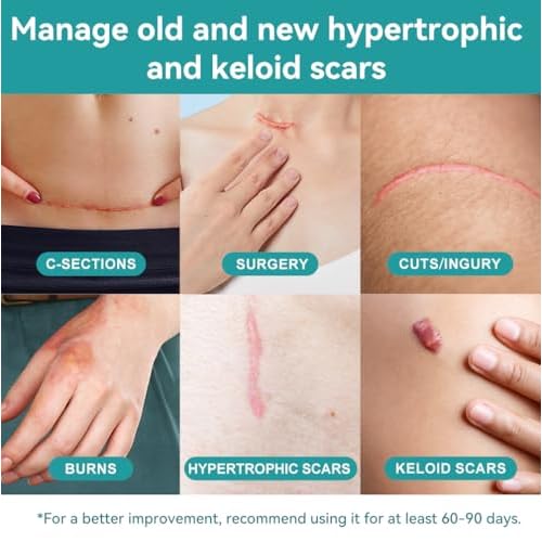 Dimora 2 Packs 6oz Hydrogel First Aid Ointment & Waterproof Silicone Scar Sheets