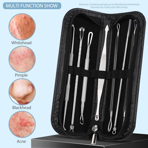 Teenitor 7-in-1 Pimple Popper Tool Kit Stainless Steel Blackhead Remover