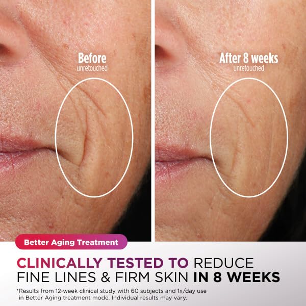 Shark CryoGlow LED Face Mask - Anti-Aging & Skin Clearing Therapy