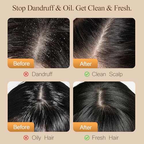 Dear Irean Anti Dandruff Shampoo & Conditioner Set with Argan Oil - Sulfate-Free Hair Care for Oily, Dry & Damaged Hair, 30.4 oz
