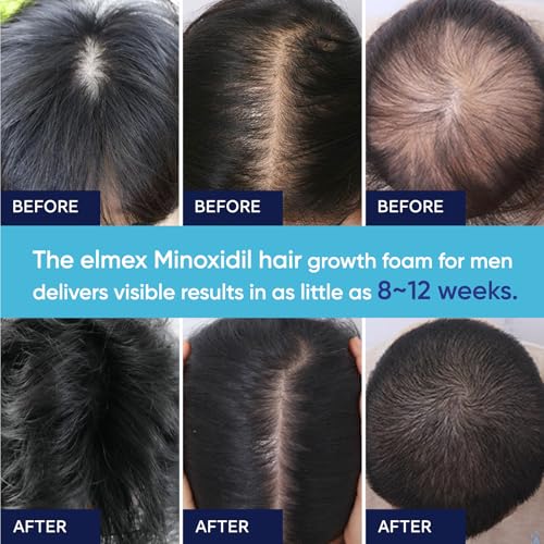 Artimore 5% Minoxidil Foam for Hair Growth Men & Women - 1 Pack