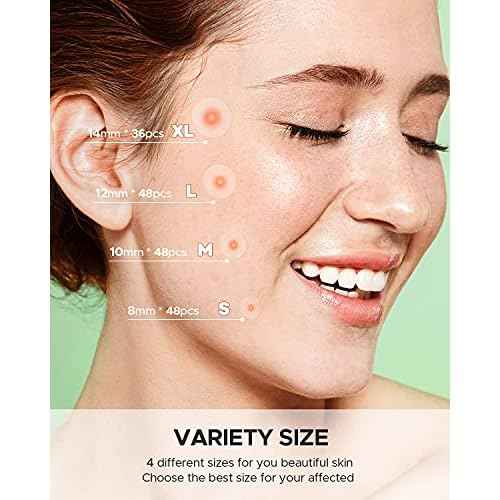 Pimple Patch (360 Counts 4 Sizes), Hydrocolliod Acne Patch for Face, Invisible Zit Patch with Tea Tree Oil & Calendula Oil, Blemish Patch