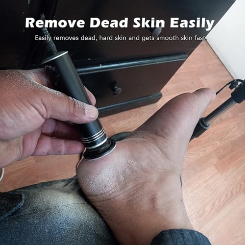 Electric Callus Remover for Feet - Professional Foot Sander & File Kit