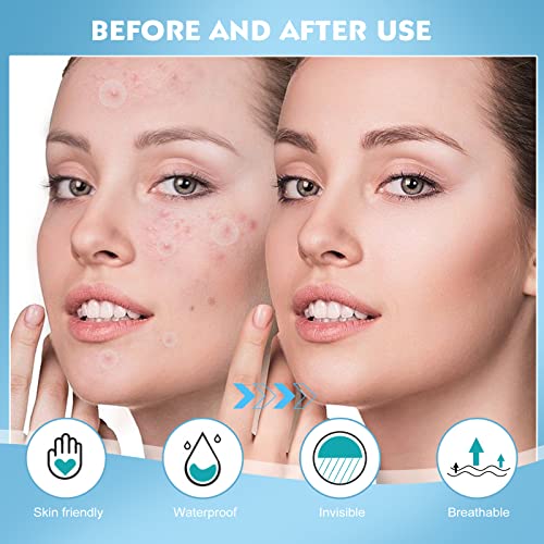 Soonuly Pimple Patches for Face - 108 Hydrocolloid Acne Pimple Patches Salicylic Acid with Tea Tree Oil for Zit Blemish Spot Covers Invisible Pimple Stickers Not Tested on Animals