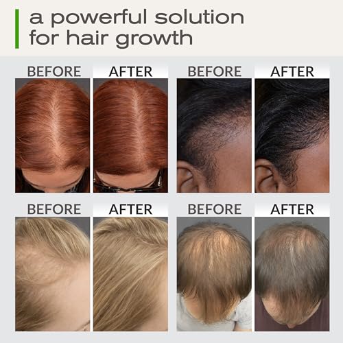 Ella & Eden Hair Growth Oil - Rosemary, Castor & Peppermint, 2 Fl Oz