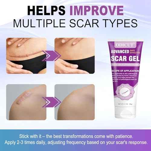 Silicone Scar Gel, Intensive Scar Cream, 2.1oz Keloid Bump Removal for Stretch Marks Removal, Surgical Scars, Cesarean Section, Acne, Injury, Burns, Doctor-tested Scar Improvement (60g)