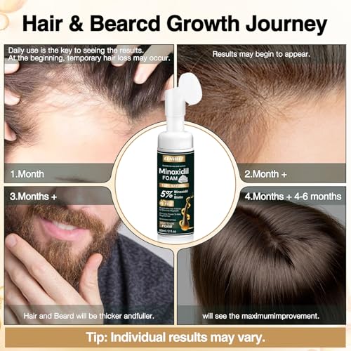 5% Minoxidil Foam for Hair Growth - 3 Pack (6.33oz)