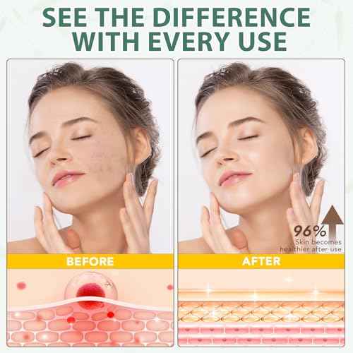 Beef Tallow for Skin, Organic Grass Fed Beef Tallow and Raw Wild Honey, Natural Whipped Tallow Balm for Face & Body Deeply Moisturizing, Body Lotion for Sensitive Skin Care, 4.2 oz