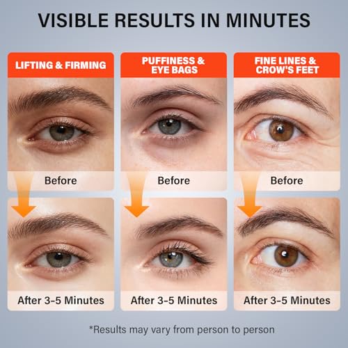 Instant Eye Tightener Cream for Under Eye Bags & Wrinkles