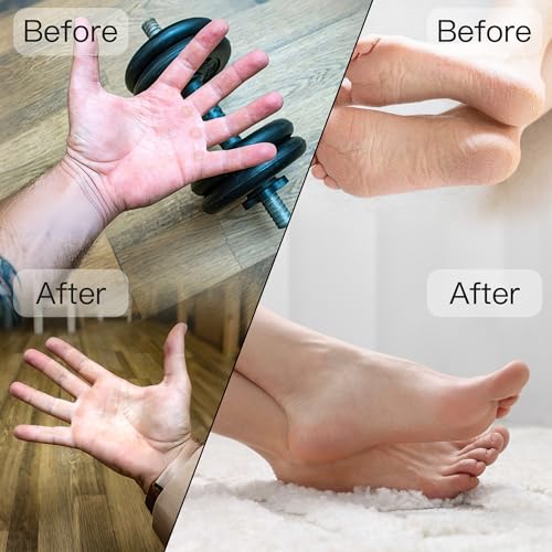 Portable Electric Callus Remover with 2 Grinding Heads - Rechargeable