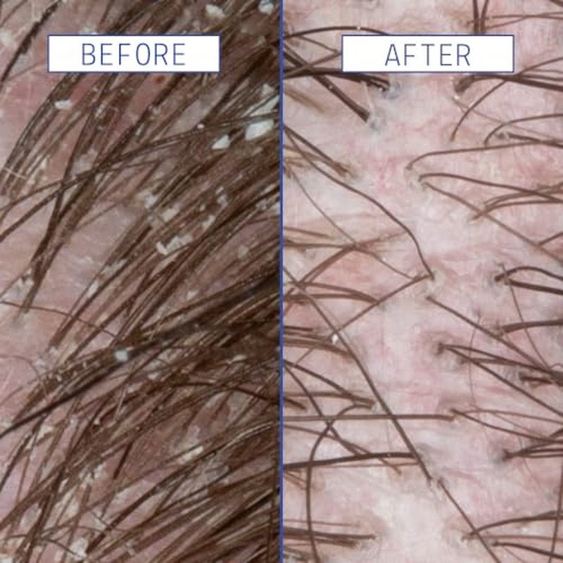 AAVRANI Scalp Rescue Hair Serum - 2 oz Scalp Comfort & Growth